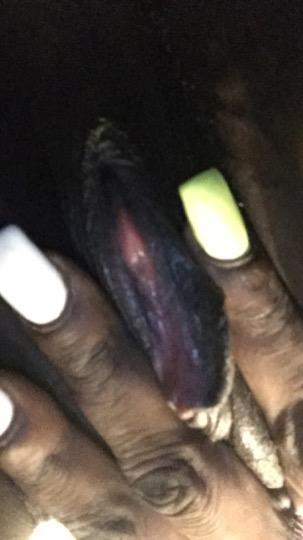 Nipples